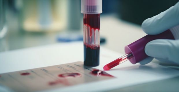 Miért hasznos a vérkép elemzése?