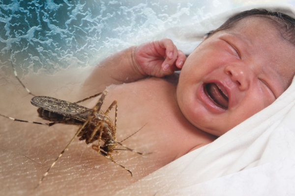 Megszületett az első kisfejű zikás baba az USA-ban