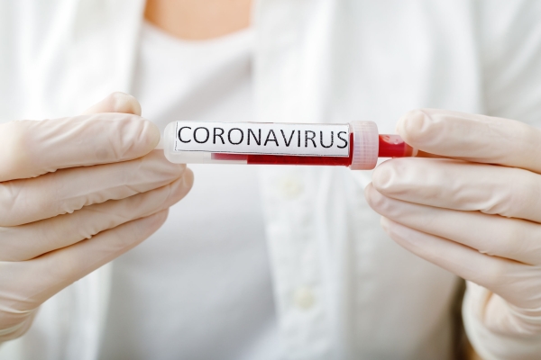 Új hírek a koronavírus elleni magyar szerről