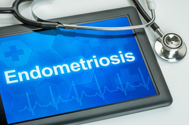 Az endometriózis kezelése műtét nélkül