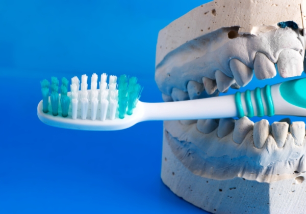 Tényleg öröklődnek a fogászati problémák?