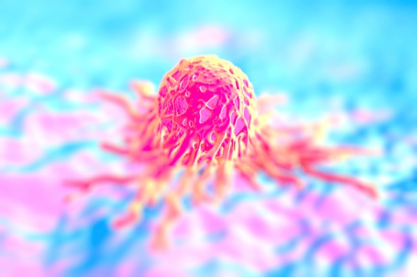 Bizonyos daganatok esetén megnő a trombózisveszély